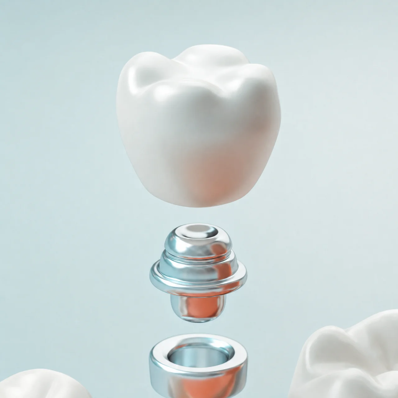 Průběh zavedení zubního implantátu